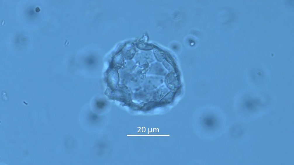 Microscopic image of a cell surrounded by smaller particles, with a measurement scale indicating 20 micrometers.