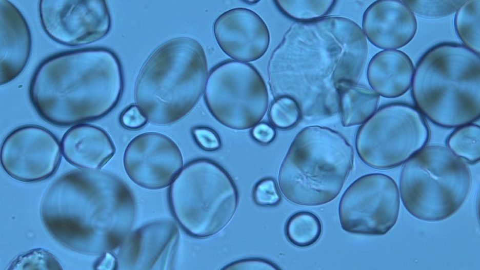 Microscopic view of transparent cells or bubbles, varying in size, with a blue tint and a 20-micrometer scale for size reference.